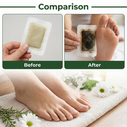Detox Foot Patches 20 Pcs Detox Foot Pads🌿✨